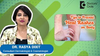 Cure for Heat Rashes / Sweat Rashes - By Dr. Rasya Dixit | Doctors