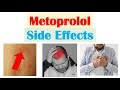 Metoprolol (& Beta Blockers) Side Effects (& Why They Occur)