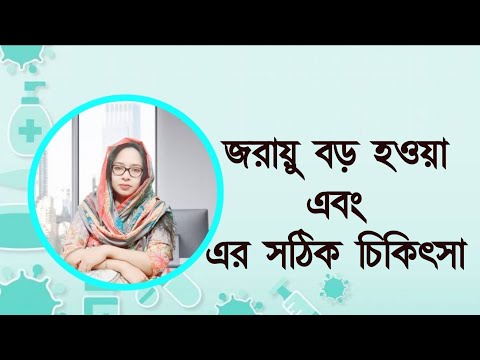 Bulky Uterus || জরায়ু বড় হওয়া এবং এর সঠিক চিকিৎসা