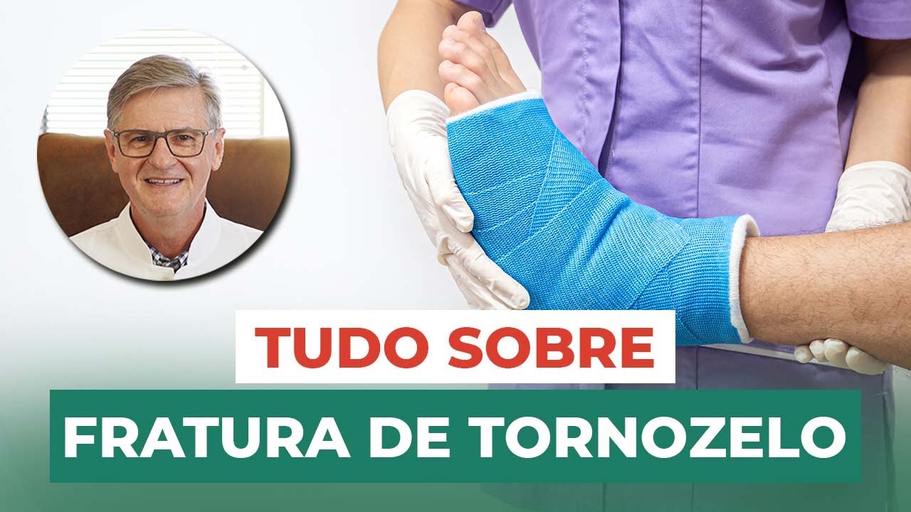 Tudo sobre Fratura de tornozelo