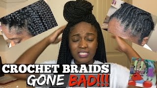 Crochet Braids Gone BAD!!! Infection? Allergic Reaction?