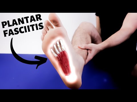 Heel Spurs Plantar Fasciitis BEST Home Treatment 2022
