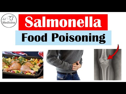 Salmonella Food Poisoning | Pathophysiology, Symptoms & Complications, Diagnosis, Treatment