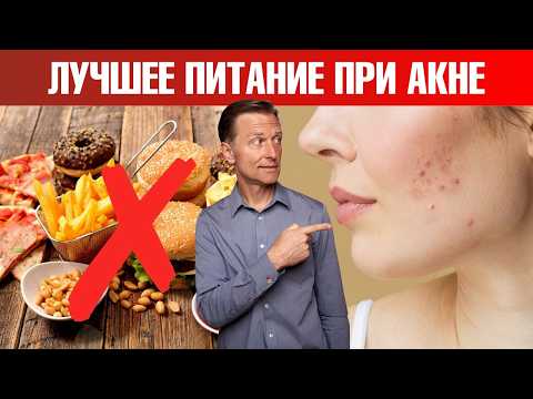 Как избавиться от акне быстрее всего?👀 Как избавиться от акне быстрее всего?👀