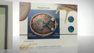 preview picture of video '(303) 471-5263 | Find vision insurance & eye problems @ Highlands Ranch Optical & Eyecare'