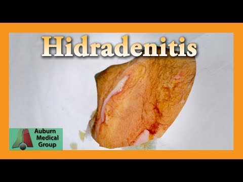 Röntgenstrahl der Hand Gelenke Rückenschmerzen Behandlung Medikamente Lende