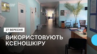 В житомирській обласній лікарні для лікування опіків використовують штучний замінник шкіри