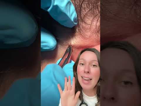 Zeckenstich #medizin