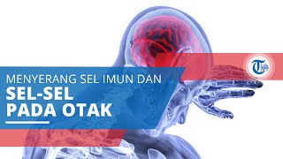Ensefalitis, Radang Otak yang Terjadi karena Infeksi Virus dengan Cara Menyerang Sistem Imun