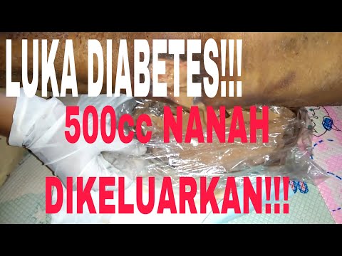 Menghapus perut bir di lingkungan home video Membeli celana sauna pelangsing