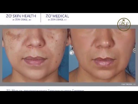 Крем против загара отбеливающий с spf 35 от floresan Отбеливающие крема с spf