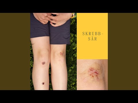 Skrubbsår