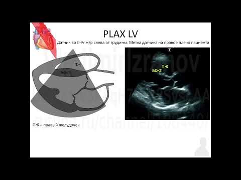ЭхоКГ Аккредсценарий №1 Введение Часть 1