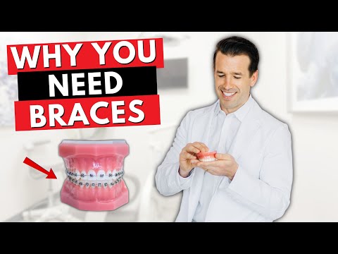 Why BRACES are better than INVISALIGN | Orthodontist | Dr. Nate