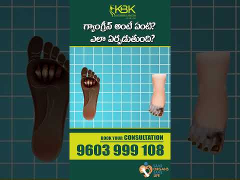 What is gangrene? Different Types of Gangrene | Dr. Aishwarya | KBK Hospitals #gangrene