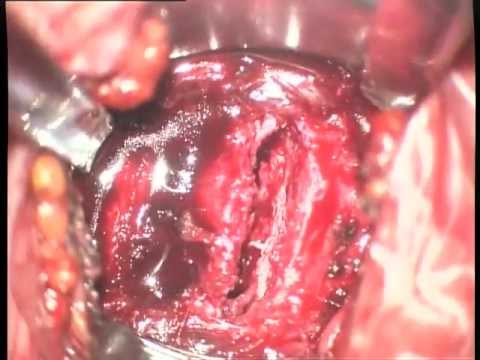Medico curante dolori articolari Dolore al collo indietro la causa