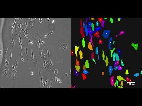 Usiigaci: Instance-aware cell tracking in phase contrast microscopy