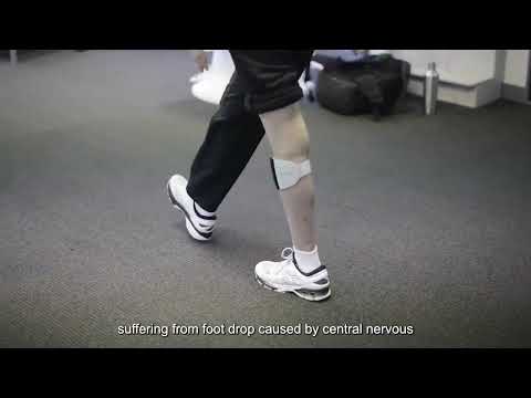 "Real-Life Demo: XFT-2001E G4 Foot Drop System | Wearable FES for Gait Training"
