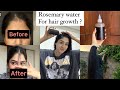 Best Lost Hair Regrowth Remedy Visible Results With Proof