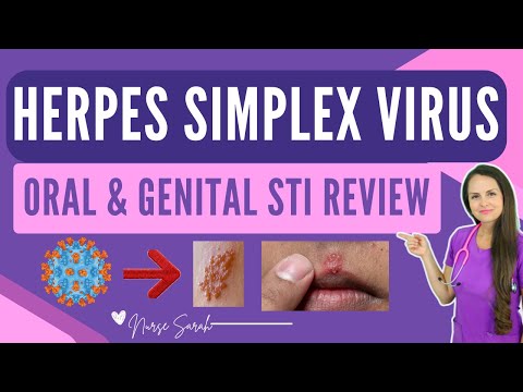 Herpes-simplex-Virus (HSV-1 & 2) – NCLEX-Prüfungsvorbereitung für Pflegekräfte im Bereich sexuell...