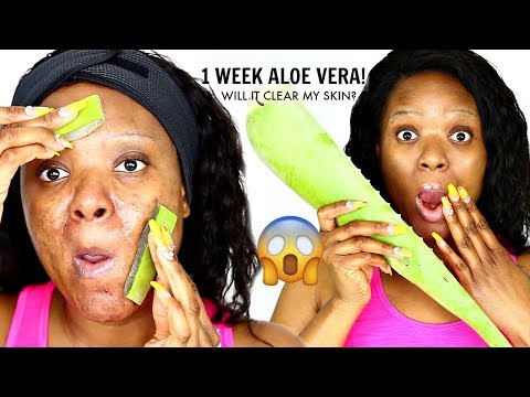 1 WEEK ALOE VERA TREATMENT ON MY FACE & THIS IS WHAT HAPPENED | OMABELLETV