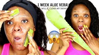 1 WEEK ALOE VERA TREATMENT ON MY FACE & THIS IS WHAT HAPPENED | OMABELLETV