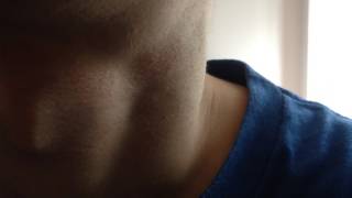 My Neck on HIV (24 hours pulsating like this)