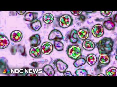 Two deaths reported in Pennsylvania measles outbreak