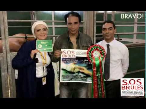SOS Brules & Raja Aboukhadija au Salon du Cheval El-Jadida 2016