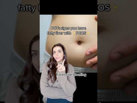 Signs you might have fatty liver with #pcos