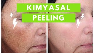 Evde Kimyasal peeling Nasıl Yapılır?