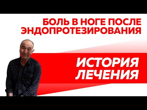 Отзыв Rekinetix. Боль в ноге, боль в колене, после эндопротезирования. Реабилитация