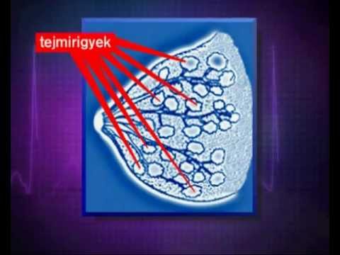 légzési papillomatosis remisszió