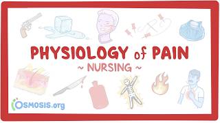 Physiology of pain: Clinical Nursing Care