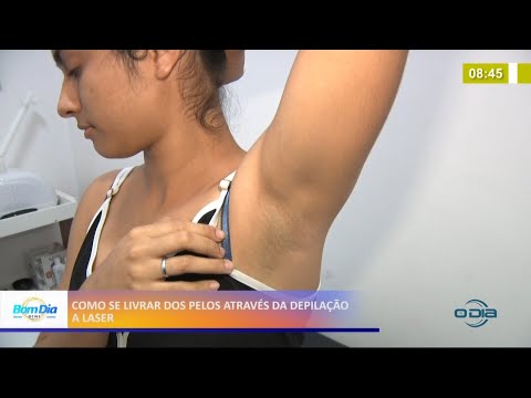 Como se livrar dos pelos através da depilação a laser 19 05 2021