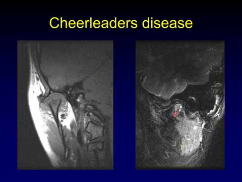 Temporomandibular Joint 2