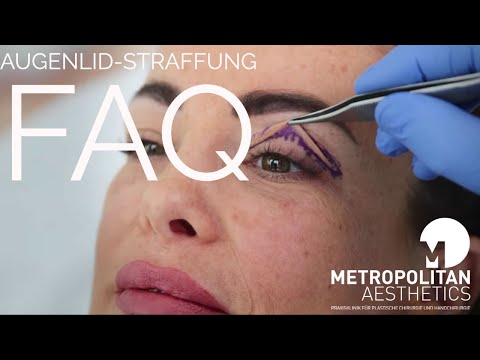 Schlupflider und Tränensäcke: Alle Infos über OP und Kosten für die Oberlidstraffung