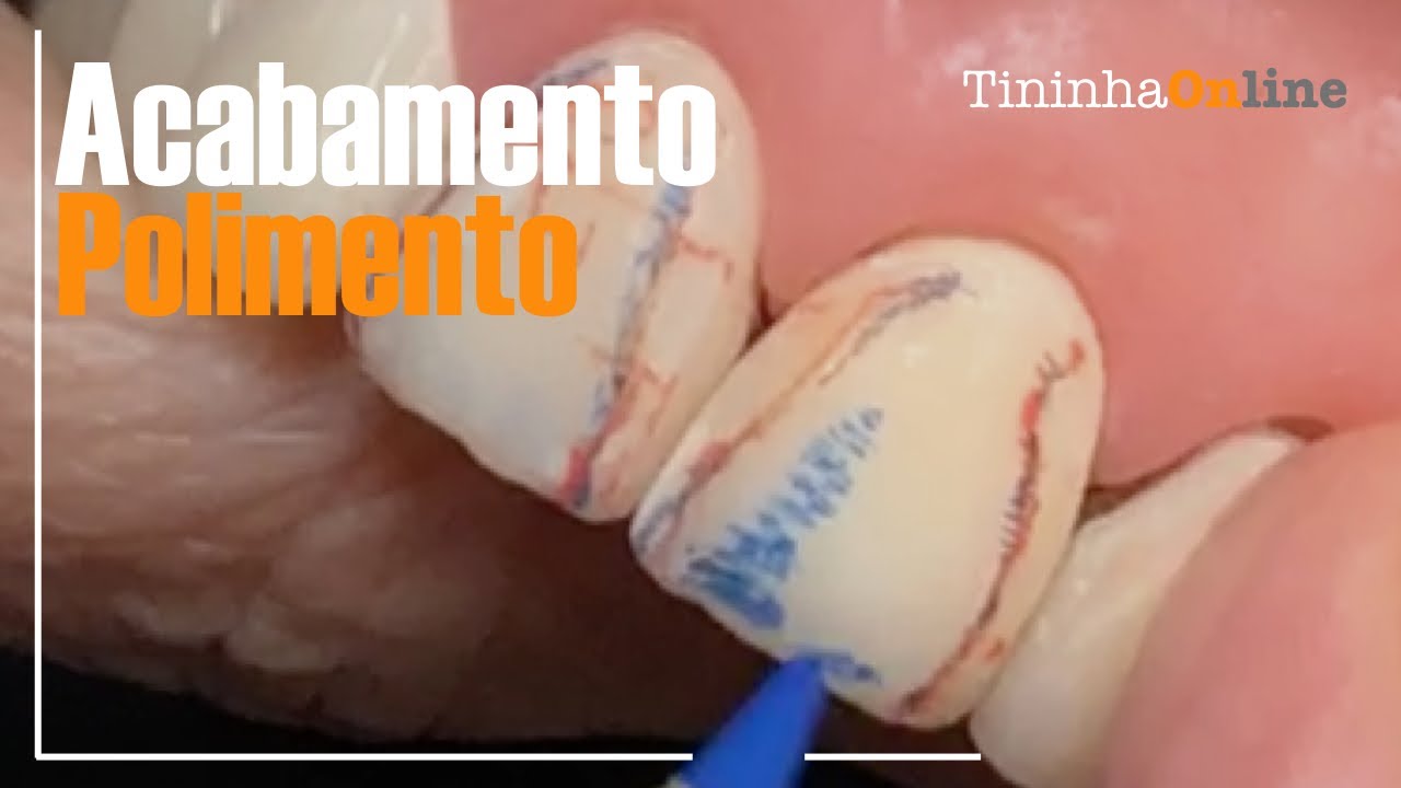 Acabamento e Polimento