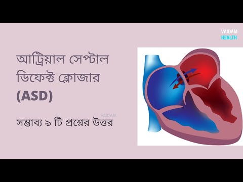 অ্যাট্রিয়াল সেপ্টাল ডিফেক্ট ক্লোজার -৯ টি প্রায়শই জিজ্ঞাসিত প্রশ্ন