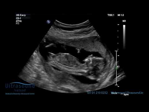 Scan of the Week: 15 Weeks Pregnant (The Advanced Early Ultrasound)