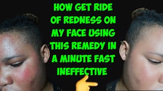 how to get rid of redness overnight face.how to remove redness on face with natural remedies
