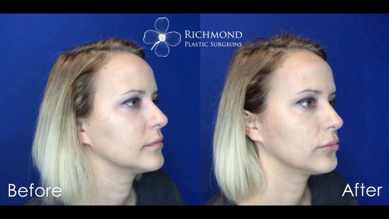 Richmond Plastic Surgeons