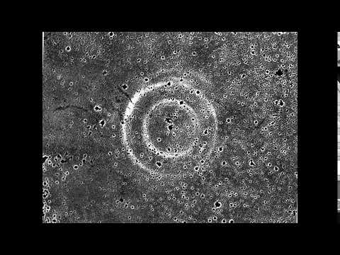 The Expanding Echoes of Supernova 1987A