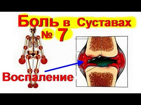 Остеохондроз ты побежден Бубновский боль в плечевом суставе видео