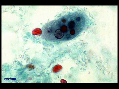 Maláriás plazmodium