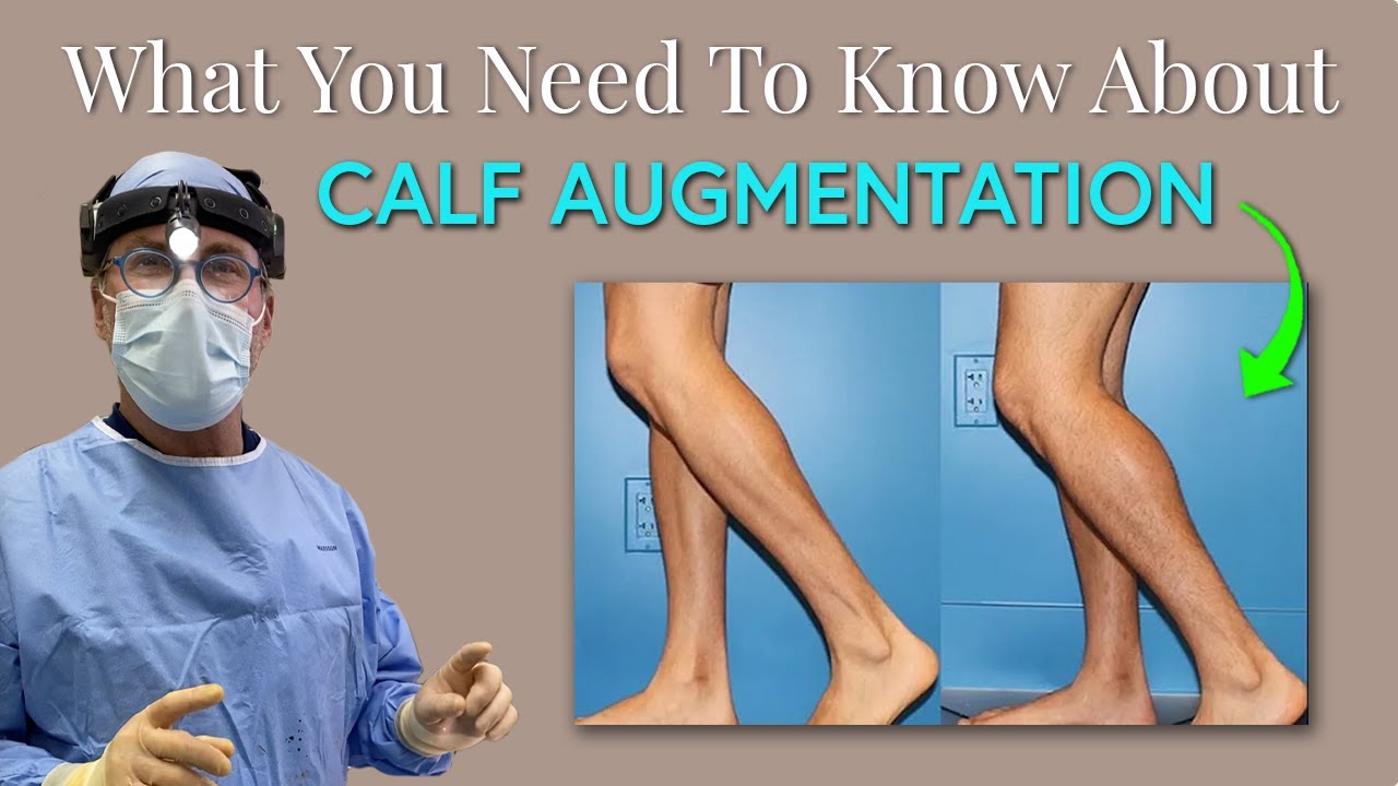 No More Skinny Legs! Calf Augmentation with Dr. Chasan