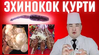 ҚУРТ ЭХИНОКОКК ДАҲШАТЛИ КУТИЛМАГАН ЮҚИШ ЙЎЛЛАРИ, ДИАГНОСТИКАСИ ВА ДАВО ЧОРА