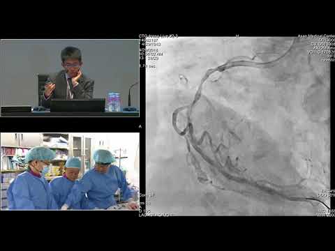 [TCTAP 2018] Master the CTO - Live Case Session II