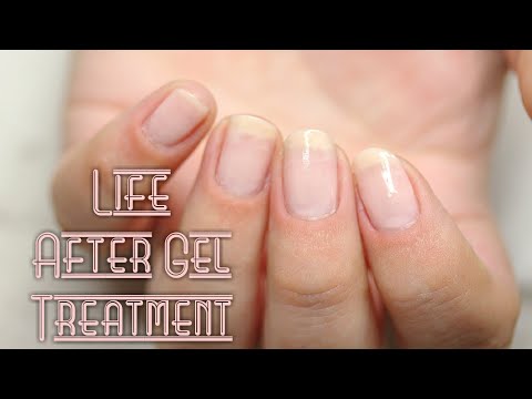 download lagu mp3 mp4 Nails After Gel Polish Removal, download lagu Nails After Gel Polish Removal gratis, unduh video klip Nails After Gel Polish Removal