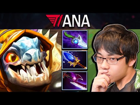 Slark Dota 2 Gameplay T1.Ana with Diffusal and Aghanims Scepter
